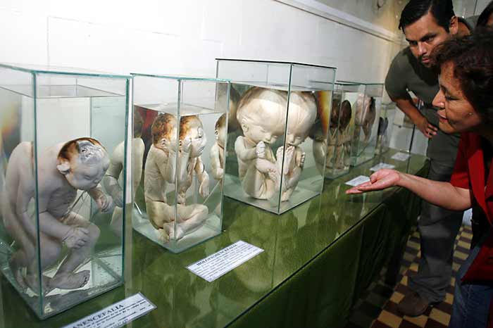 Lima's Brain Museum